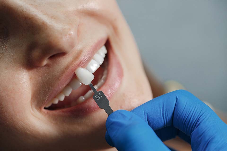 Cosmetic Dentistry Veneers by Enspire Dental, Ann Arbor, MI Cosmetic Dentistry Veneers: What To Know