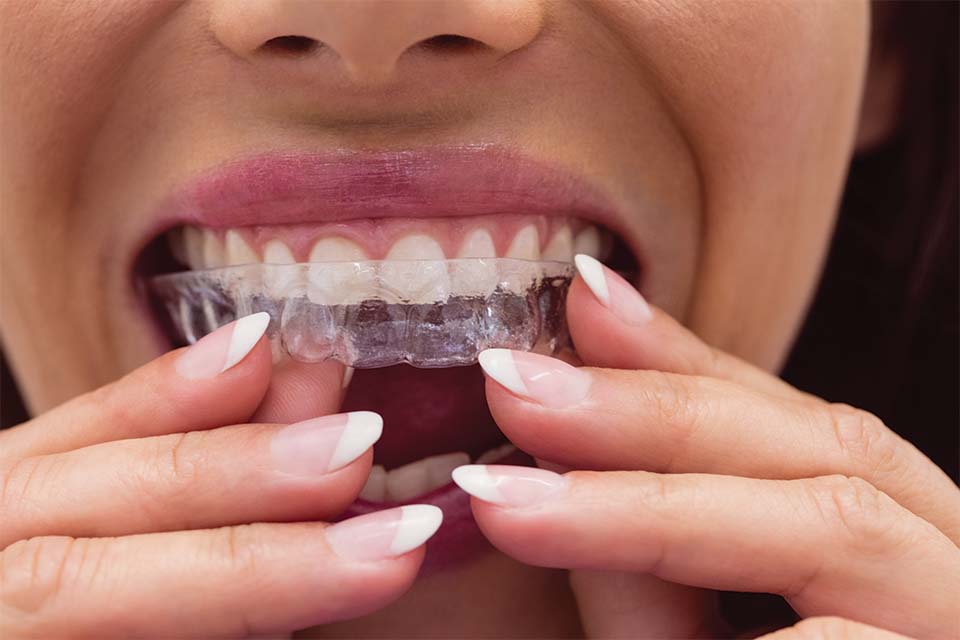 Cosmetic Dentistry Options: Which Treatment Is Right for Your Smile Cosmetic Dentistry Options: Which Treatment Is Right for Your Smile