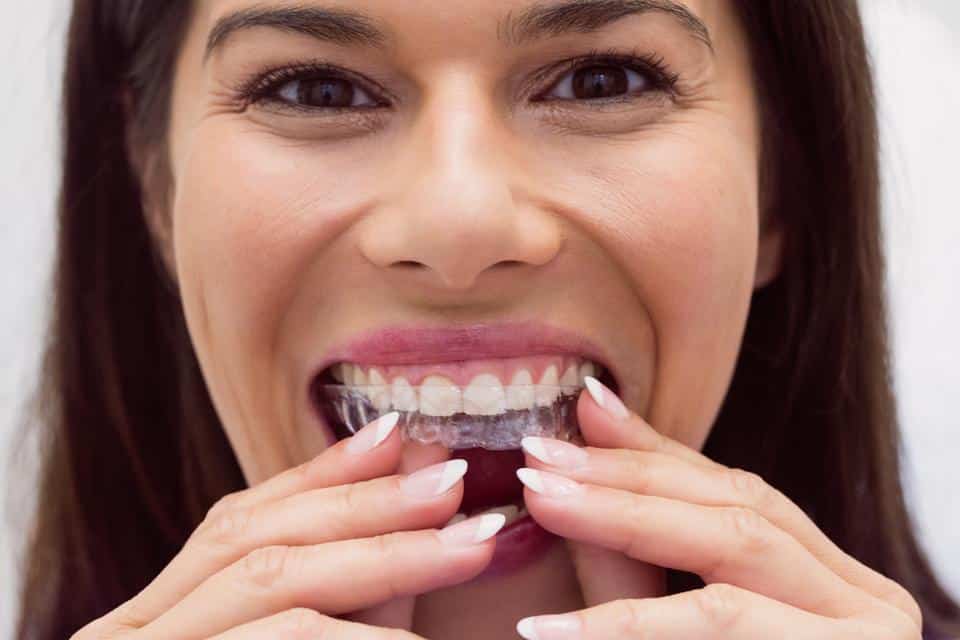 The Enspire Standard: Why Elite Sports Protection Requires a Custom Athletic Mouthguard